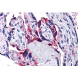 Immunohistochemistry - Anti-APH1A Antibody (A82710) - Antibodies.com