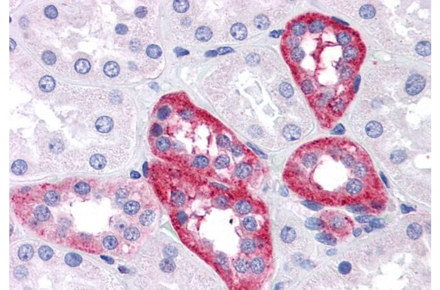 Immunohistochemistry - Anti-APH1A Antibody (A82710) - Antibodies.com