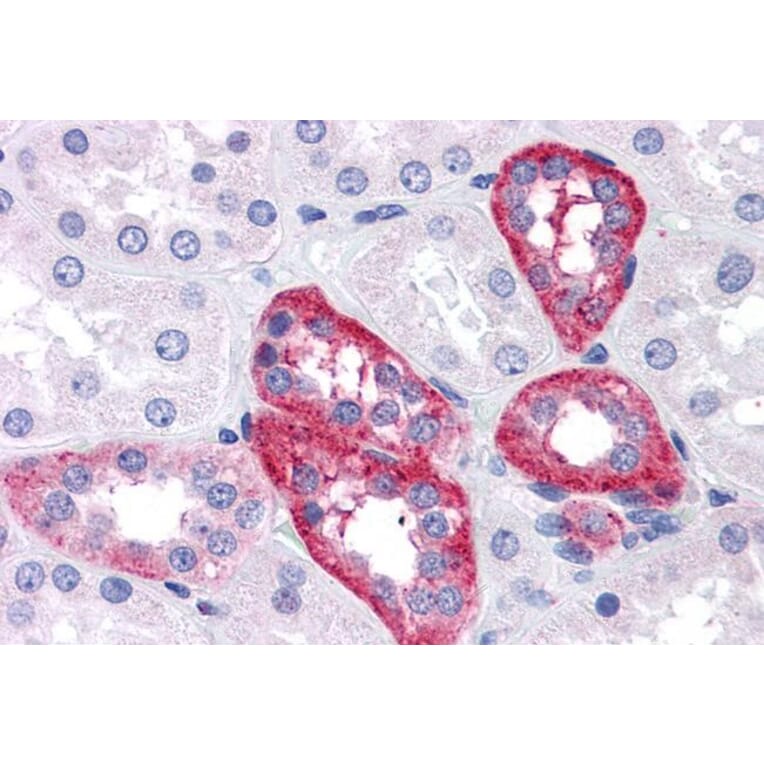 Immunohistochemistry - Anti-APH1A Antibody (A82710) - Antibodies.com