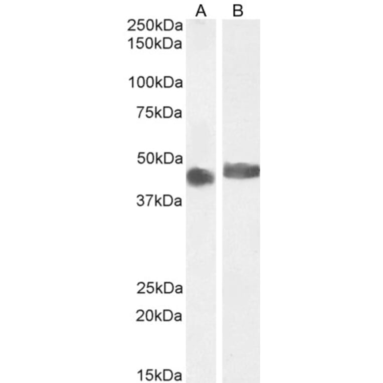 Western Blot - Anti-CCM2 Antibody (A82712) - Antibodies.com