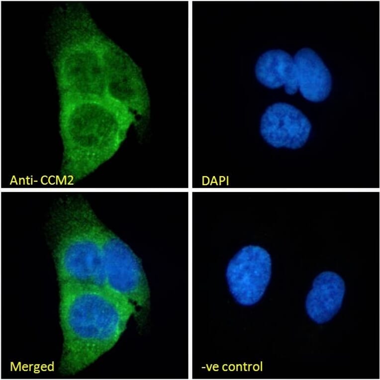 Immunofluorescence - Anti-CCM2 Antibody (A82712) - Antibodies.com