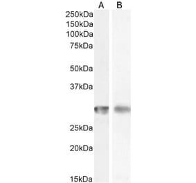 Western Blot - Anti-CD4 Antibody (A82715) - Antibodies.com