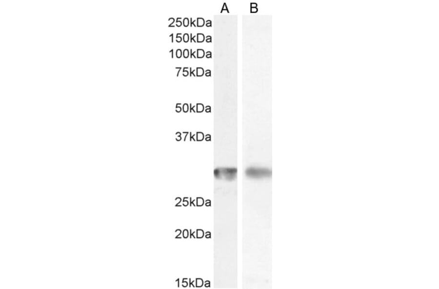 Western Blot - Anti-CD4 Antibody (A82715) - Antibodies.com