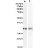 Western Blot - Anti-CD4 Antibody (A82715) - Antibodies.com