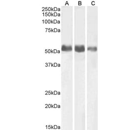 Western Blot - Anti-ALPL Antibody (A82716) - Antibodies.com
