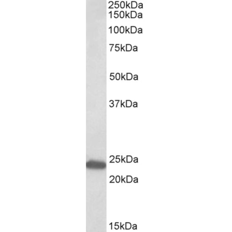 Western Blot - Anti-GM2A Antibody (A82717) - Antibodies.com