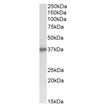 Western Blot - Anti-delta Sarcoglycan Antibody (A82720) - Antibodies.com