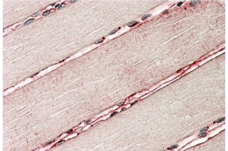 Immunohistochemistry - Anti-delta Sarcoglycan Antibody (A82720) - Antibodies.com