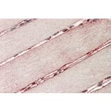 Immunohistochemistry - Anti-delta Sarcoglycan Antibody (A82720) - Antibodies.com
