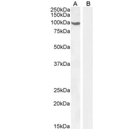 Western Blot - Anti-Androgen Receptor Antibody (A82721) - Antibodies.com