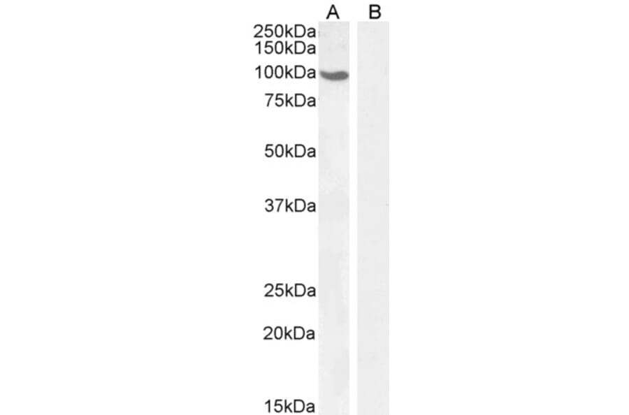 Western Blot - Anti-Androgen Receptor Antibody (A82721) - Antibodies.com