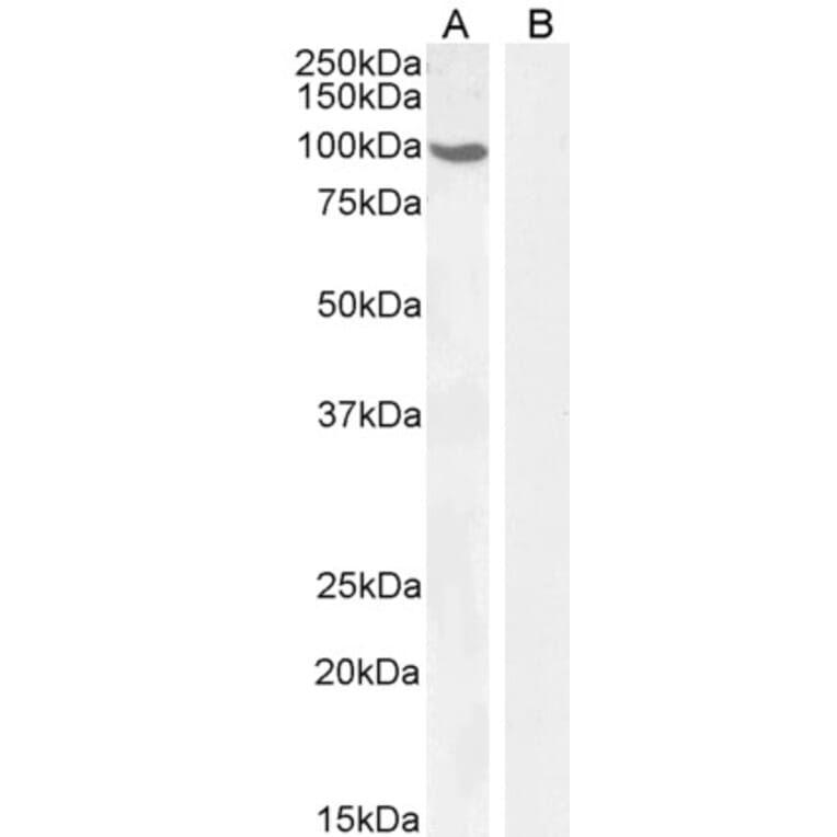 Western Blot - Anti-Androgen Receptor Antibody (A82721) - Antibodies.com