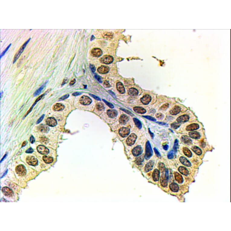 Immunohistochemistry - Anti-Androgen Receptor Antibody (A82721) - Antibodies.com