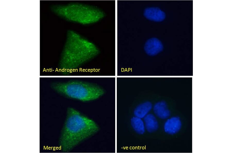 Immunofluorescence - Anti-Androgen Receptor Antibody (A82721) - Antibodies.com