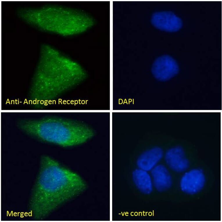 Immunofluorescence - Anti-Androgen Receptor Antibody (A82721) - Antibodies.com