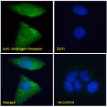 Immunofluorescence - Anti-Androgen Receptor Antibody (A82721) - Antibodies.com