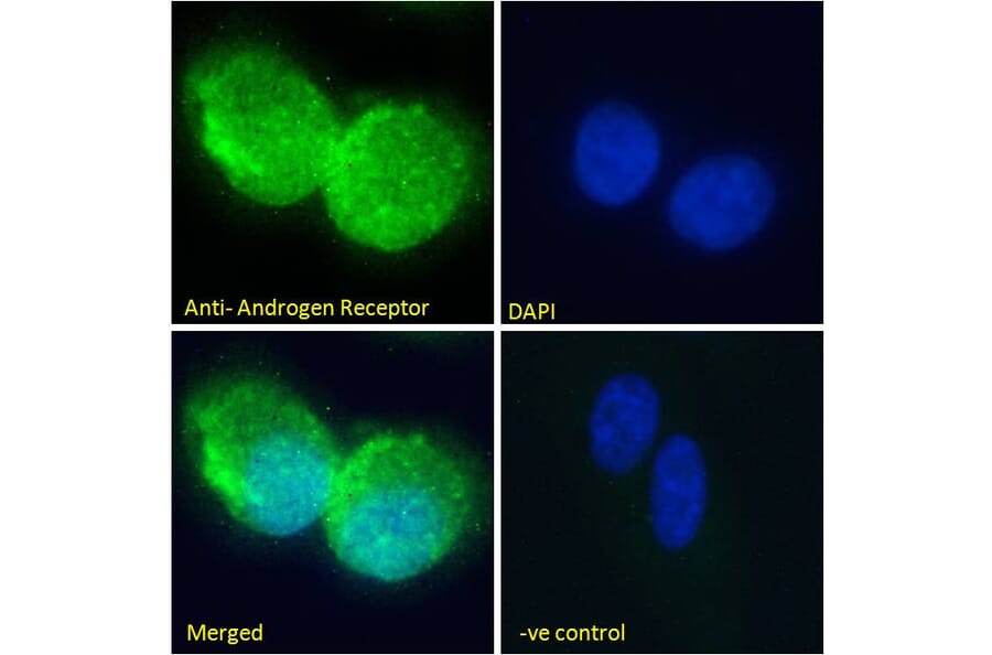 Immunofluorescence - Anti-Androgen Receptor Antibody (A82721) - Antibodies.com