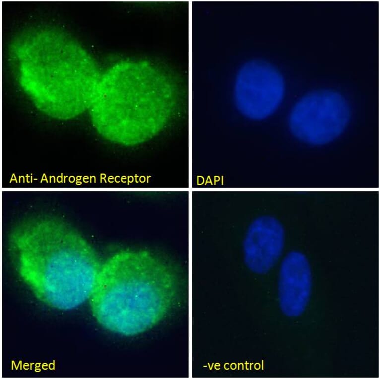 Immunofluorescence - Anti-Androgen Receptor Antibody (A82721) - Antibodies.com