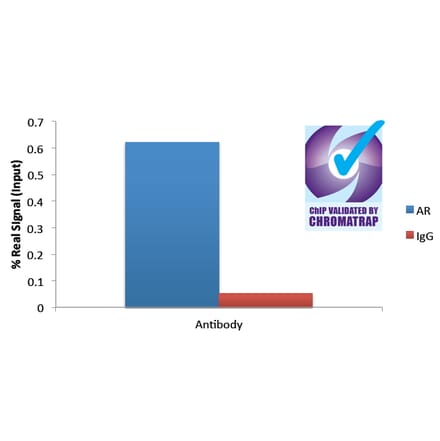 Chromatin Immunoprecipitation - Anti-AR Antibody (A82721) - Antibodies.com