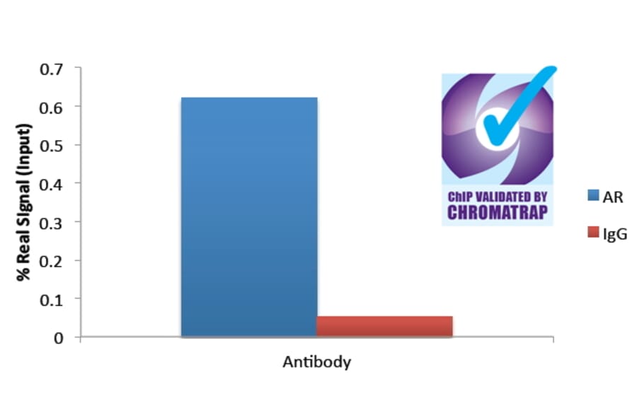 ChIP - Anti-Androgen Receptor Antibody (A82721) - Antibodies.com