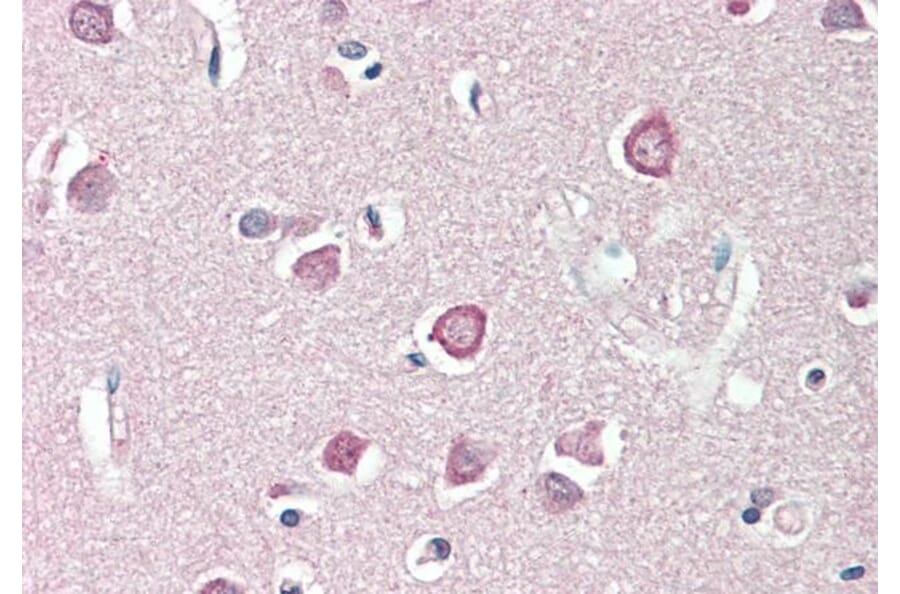 Immunohistochemistry - Anti-ENPP2/ATX Antibody (A82722) - Antibodies.com