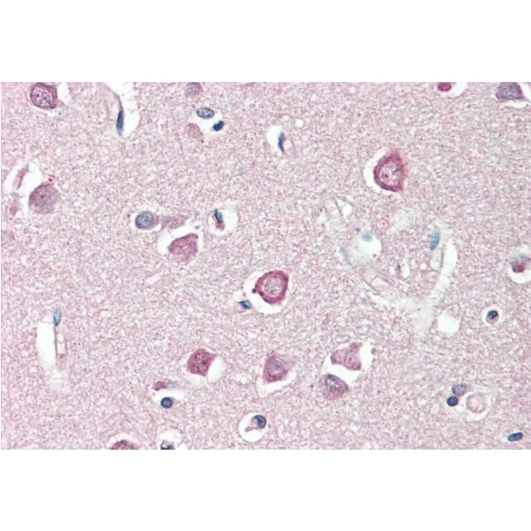 Immunohistochemistry - Anti-ENPP2/ATX Antibody (A82722) - Antibodies.com