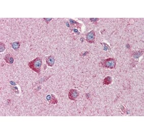 Immunohistochemistry - Anti-24p3R Antibody (A82727) - Antibodies.com