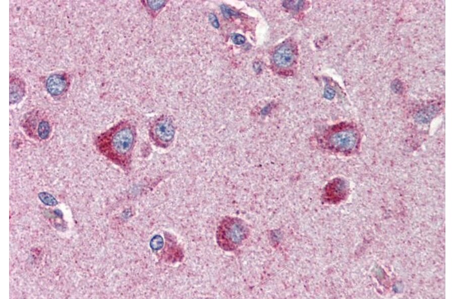 Immunohistochemistry - Anti-24p3R Antibody (A82727) - Antibodies.com