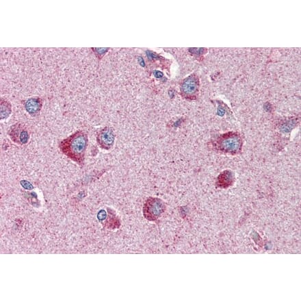 Immunohistochemistry - Anti-24p3R Antibody (A82727) - Antibodies.com