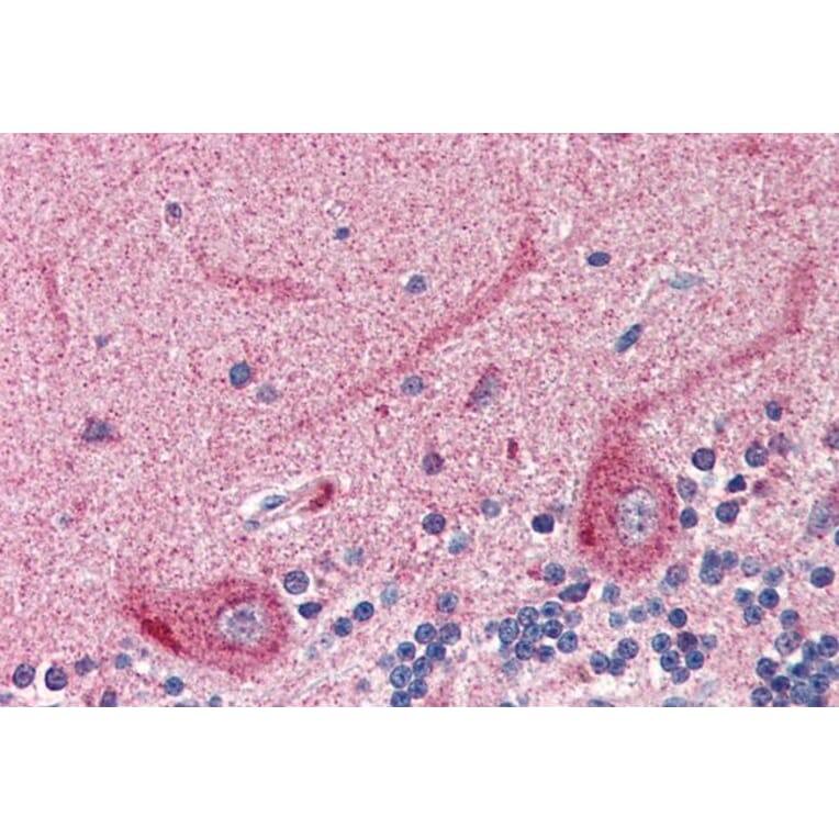 Immunohistochemistry - Anti-24p3R Antibody (A82727) - Antibodies.com