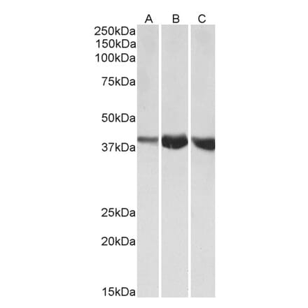Western Blot - Anti-ALDOA Antibody (A82729) - Antibodies.com