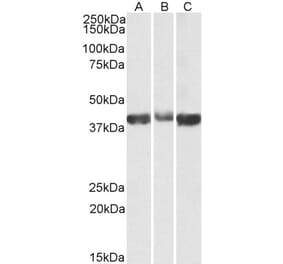 Western Blot - Anti-Aldolase Antibody (A82730) - Antibodies.com