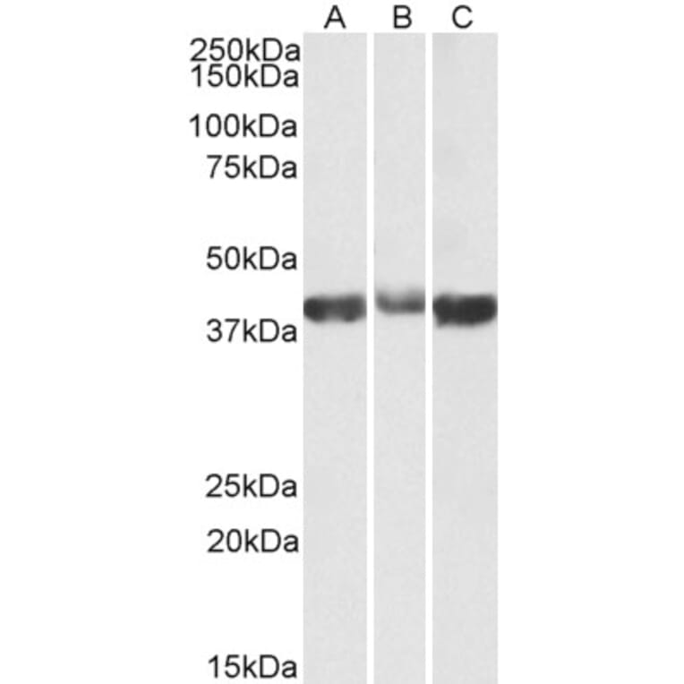 Western Blot - Anti-Aldolase Antibody (A82730) - Antibodies.com