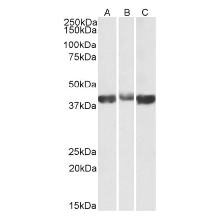 Western Blot - Anti-ALDOA Antibody (A82730) - Antibodies.com