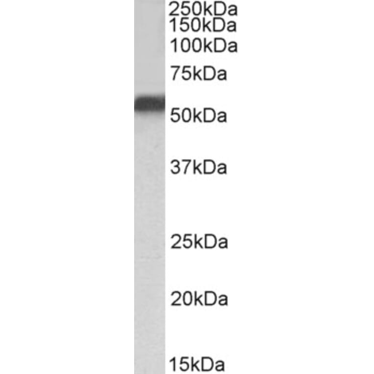 Western Blot - Anti-NR5A2/LRH1 Antibody (A82731) - Antibodies.com