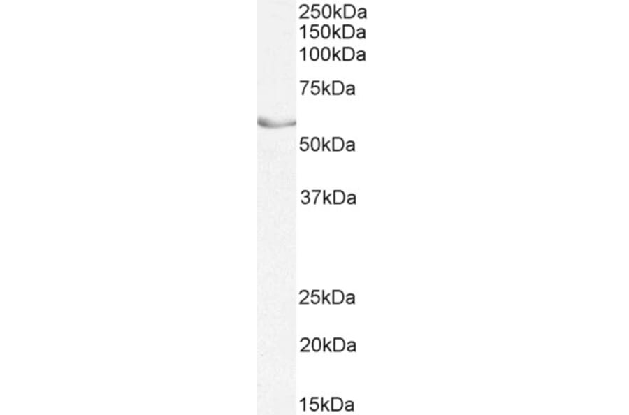 Western Blot - Anti-NR5A2/LRH1 Antibody (A82731) - Antibodies.com