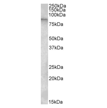 Western Blot - Anti-TRPC4AP Antibody (A82733) - Antibodies.com