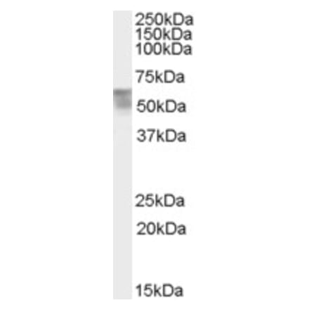 Western Blot - Anti-Thyroid Hormone Receptor alpha Antibody (A82734) - Antibodies.com