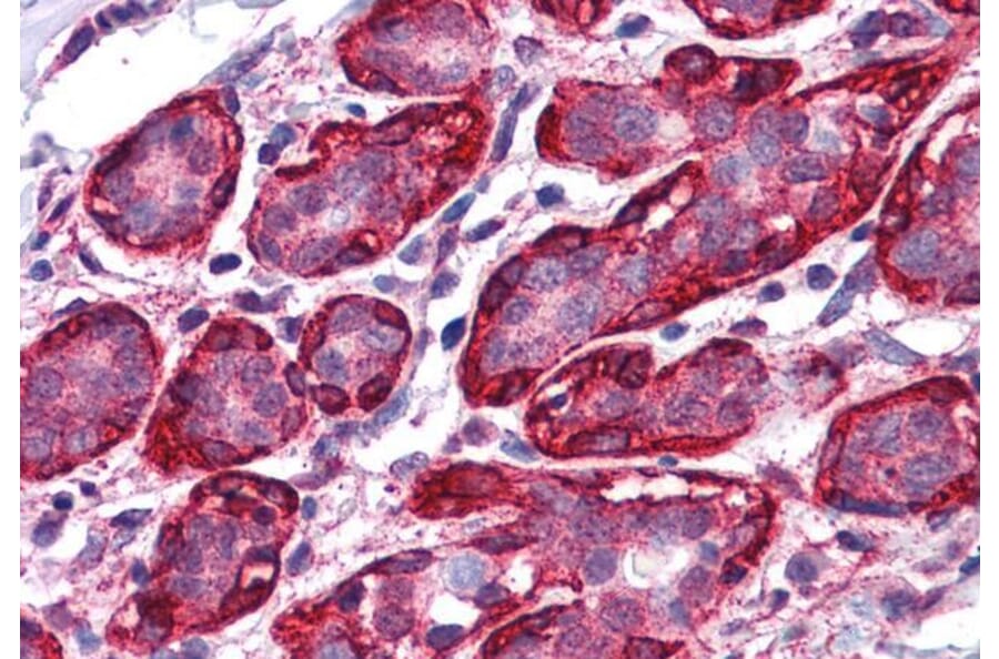Immunohistochemistry - Anti-Thyroid Hormone Receptor alpha Antibody (A82734) - Antibodies.com