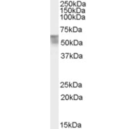 Western Blot - Anti-THRA Antibody (A82734) - Antibodies.com
