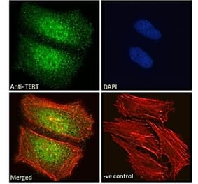 Immunofluorescence - Anti-Telomerase Reverse Transcriptase Antibody (A82735) - Antibodies.com