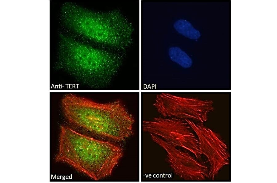 Immunofluorescence - Anti-Telomerase Reverse Transcriptase Antibody (A82735) - Antibodies.com