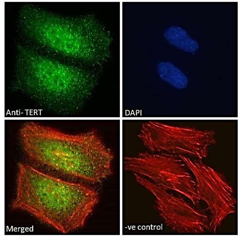 Immunofluorescence - Anti-Telomerase Reverse Transcriptase Antibody (A82735) - Antibodies.com