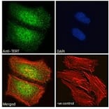 Immunofluorescence - Anti-Telomerase Reverse Transcriptase Antibody (A82735) - Antibodies.com