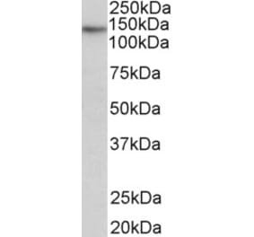 Western Blot - Anti-TERT Antibody (A82735) - Antibodies.com