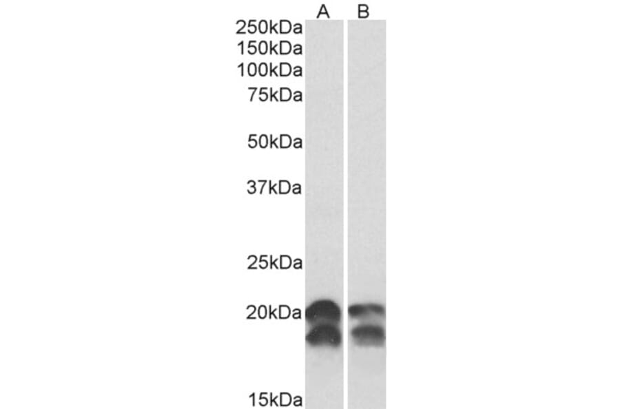 Western Blot - Anti-NM23A Antibody (A82736) - Antibodies.com