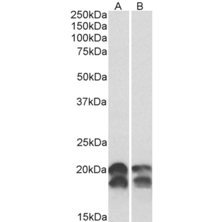 Western Blot - Anti-NM23A Antibody (A82736) - Antibodies.com