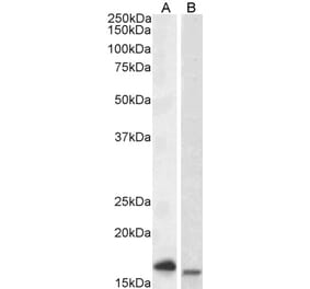 Western Blot - Anti-CD3 zeta Antibody (A82737) - Antibodies.com