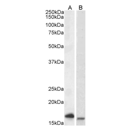 Western Blot - Anti-CD3 zeta Antibody (A82737) - Antibodies.com