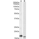 Western Blot - Anti-CD3 zeta Antibody (A82737) - Antibodies.com